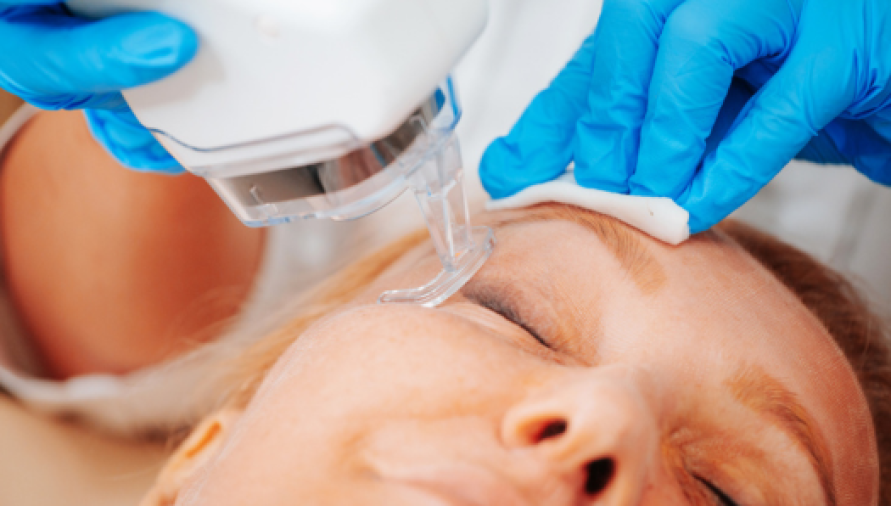 Fractional C02 Laser Resurfacing